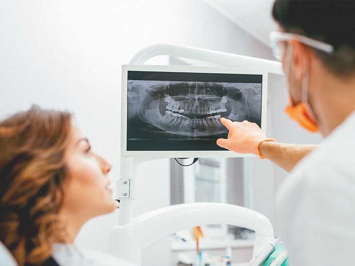 Importance of Dental Exams and X-rays