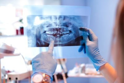  Dental Exams and X-rays