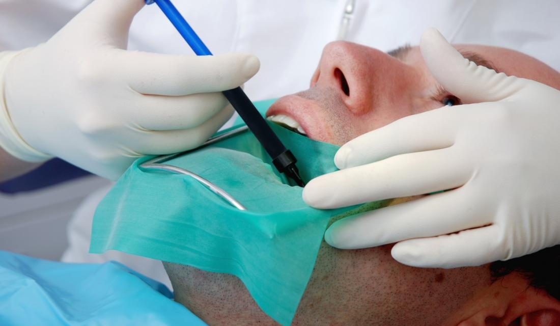 What You Need to Know When You Are Getting a Root Canal