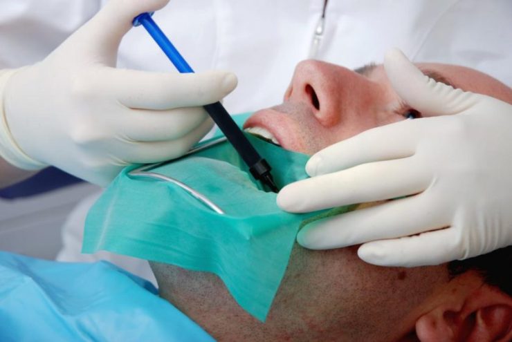 Root Canal Treatment In Palm Bay - Dental Clinic