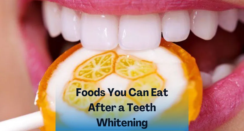 Foods You Can Eat After a Teeth Whitening
