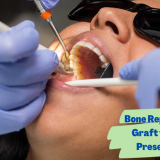 Bone replacement graft for ridge preservation