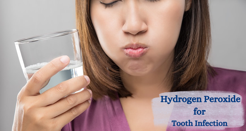 Hydrogen Peroxide for Tooth Infection