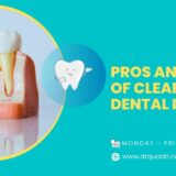 pros and cons of clear choice dental implants