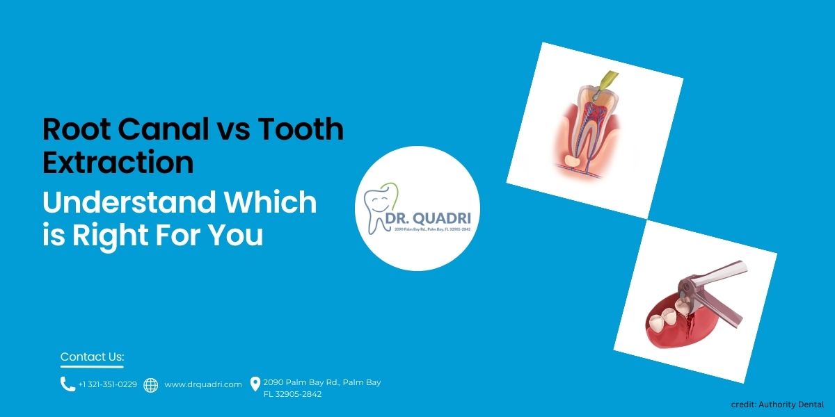 Root Canal vs Tooth Extraction: Making the Right Choice for Dental Pain Relief