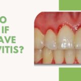 How To Know If You Have Gingivitis (1)