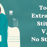 Tooth Extraction Stitches VS No Stitches