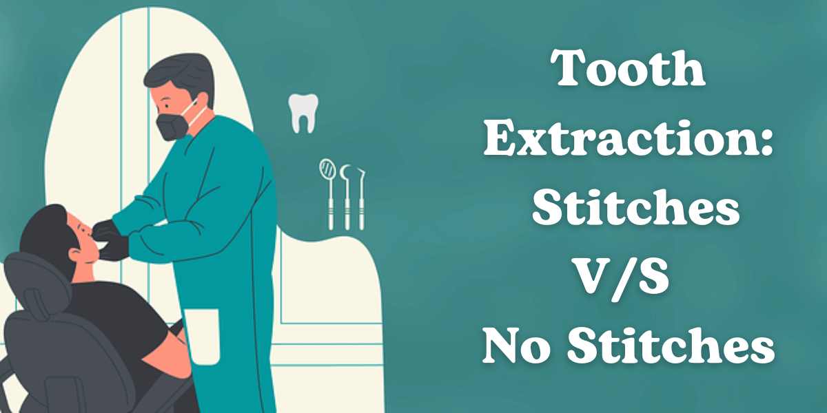 Tooth Extraction: Stitches V/S No Stitches