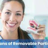 Pros and Cons of Removable Partial Dentures.