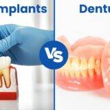 Differences Between Dental Implants and Dentures