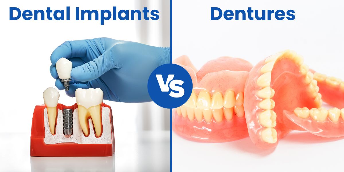 Differences Between Dental Implants and Dentures