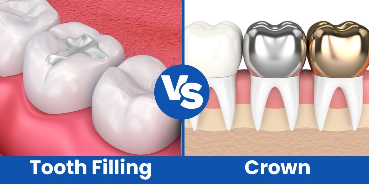 Tooth Filling vs Crown