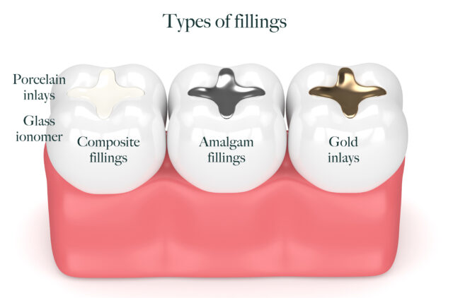 types-of-fillings