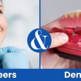 Difference Between Veneers and Dentures