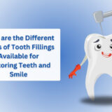 What are the Different Types of Tooth Fillings Available for Restoring Teeth and Smile